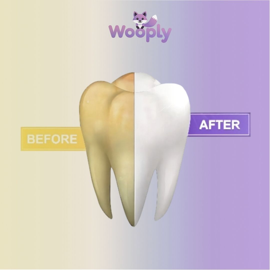 Eelhoe ColorCorrect™ V34 - Blanqueador Dental