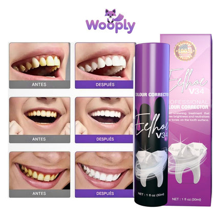 Eelhoe ColorCorrect™ V34 - Blanqueador Dental